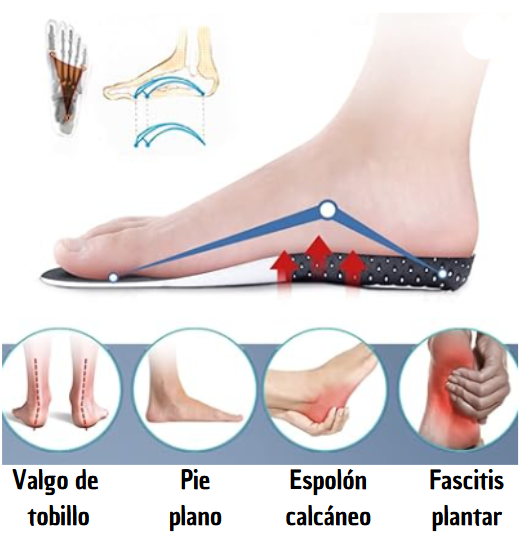 Plantilla ortopédica para dolor de pies